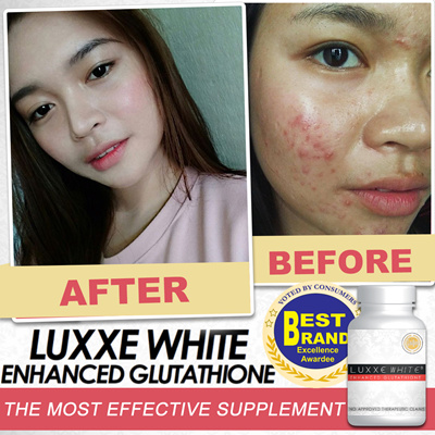 Qoo10 - Luxxe White Enhanced Glutathione Most Effective 