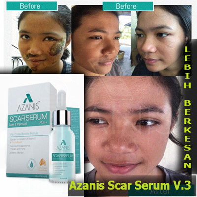 Qoo10 - Azanis Scar Serum : Cosmetics