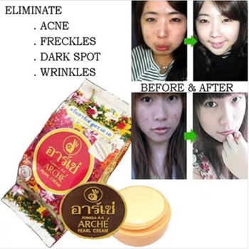 Qoo10 SG SELLER ARCHE PURE PEARL CREAM ELIMINATE ACNE