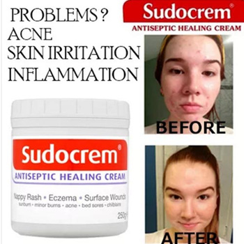 SUDOCREM 125gm Nappy Rash Antiseptic healing cream Price in India