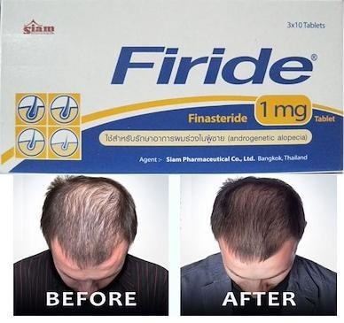 Qoo10 - Best Choice! To reduce Hair Loss in men : Hair Care Qoo10 - Best Choice! To reduce Hair Loss in men : Hair Care