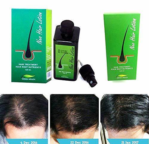 Qoo10 - Original Thai Neo Hair Lotion / Anti-Hair Loss Serum / Thinning  Soluti... : Hair Care