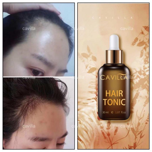 Qoo10 Free Shipping Cavilla Hair Tonic Old Packaging 30ml Hair Care
