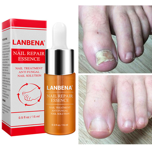 Quube -LANBENA Nail Repair Essence Serum Fungal Nail Treatment Remove ...