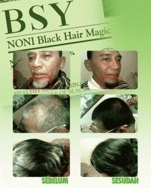 Buy BSY Noni bikin rambut makin kilau seperti Bak Artis 