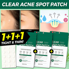 🌟1+1+1🌟 [SOME BY MI] 30DAYS MIRACLE CLEAR SPOT PATCH 10mm 12mm 2 sizes / SKIN TROUBLE CARE