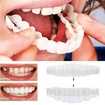 Tooth Repair Kit, Moldable Fake Teeth for Temporary Teeth, Missing