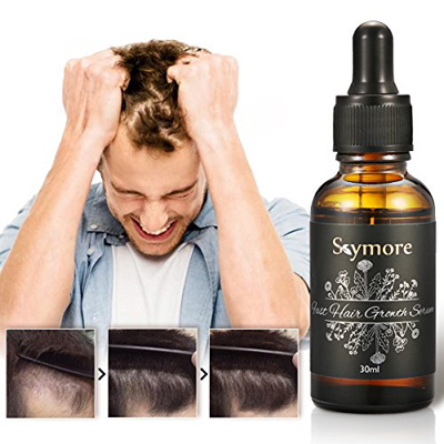 Skymore 30ml Fast Hair Growth Serum Anti Hair Loss Hair Thinning Treatment 100 Pure Natural