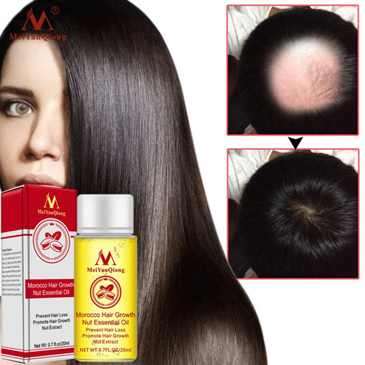 Qoo10 - Fast Powerful Hair Growth Essence Hair Loss Products Essential ...